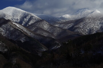 幼儿怎样保护牙齿